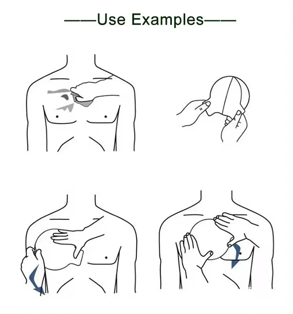 Parche torácico, ventilados y no ventilados